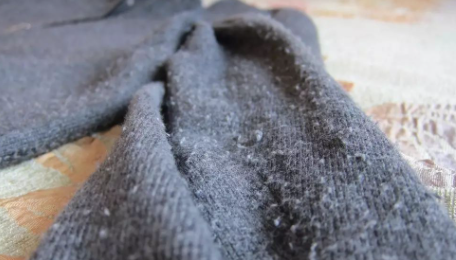 羊绒裤会起球粘毛吗羊绒裤起球怎么办(羊绒裤会鼓包吗)