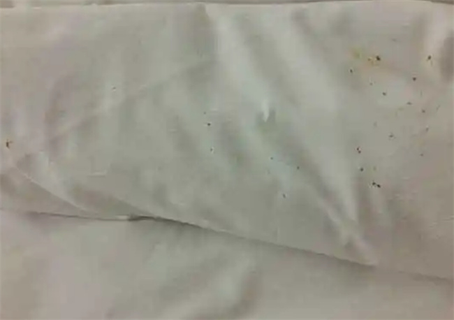 头上为什么会有螨虫呢头螨是什么原因造成的(头上有螨虫怎么办有哪些方法)