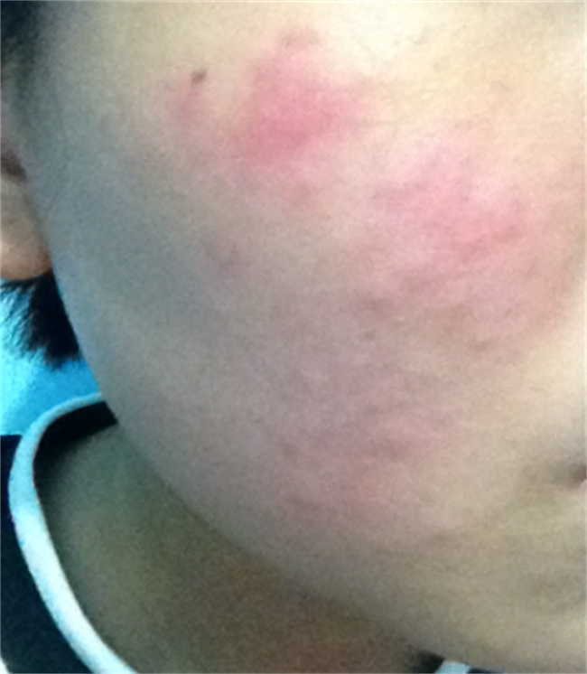 菊花茶哪些人不适合喝