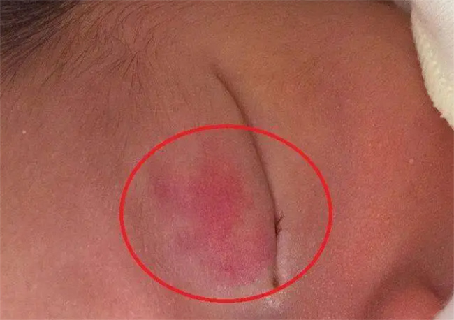 怀孕时吵架对胎儿有什么影响