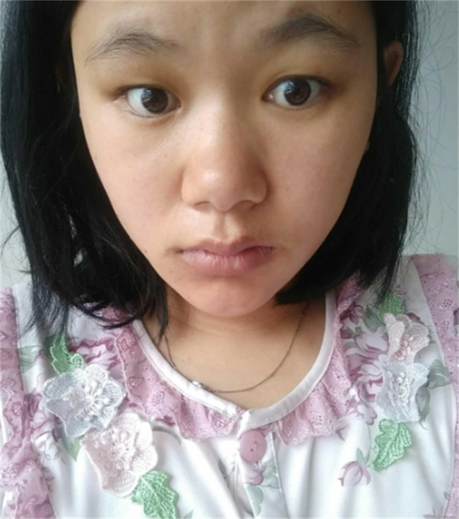 怀孕后皮肤变差正常吗怀孕之后皮肤变得很差怎么回事(怀孕之后皮肤越来越差)