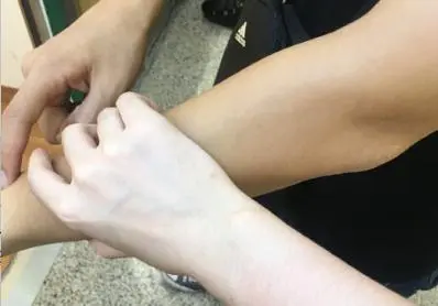 橄榄皮能变成冷白皮吗橄榄皮怎么分辨(橄榄皮是暖皮还是冷皮)