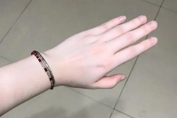 橄榄皮是暖皮还是冷皮