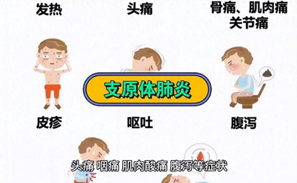 支原体肺炎主要症状