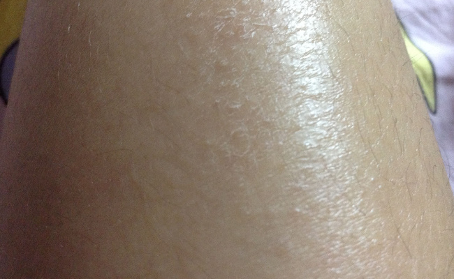 ​皮肤为什么每分钟会脱落皮肤细胞皮肤细胞包括什么(戈登发明的皮肤细胞什么术)