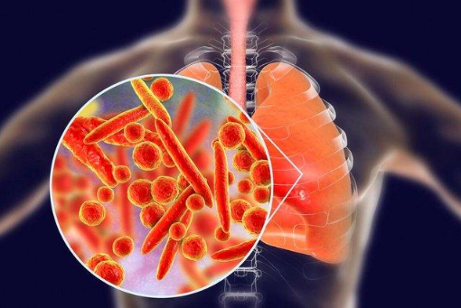 支原体肺炎传染性大吗