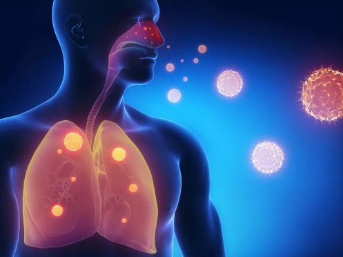 支原体肺炎传染性大吗