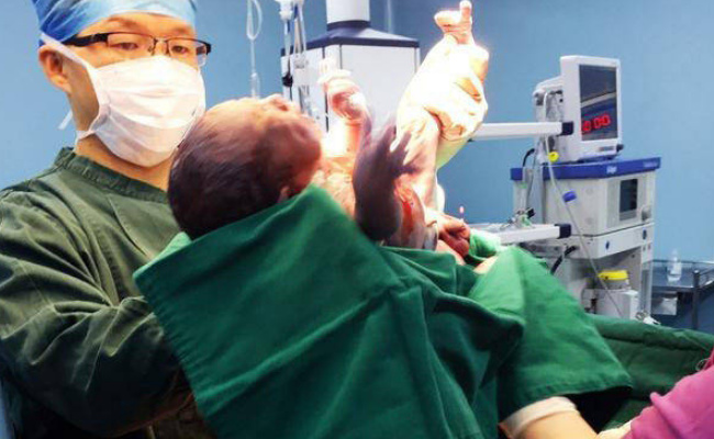 孕36周后胎儿体重还会增加多少