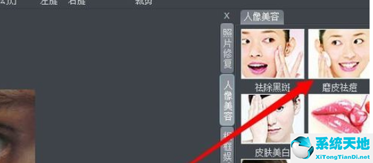 磨皮去痘坑的效果图(磨皮祛痘印有用吗)