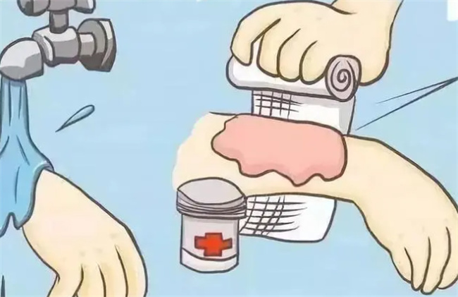 高温油烫伤后怎么办