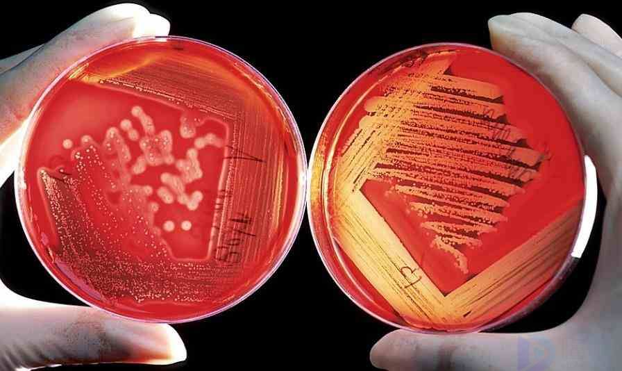 盘星藻和纤维藻的关联(盘星藻特征)