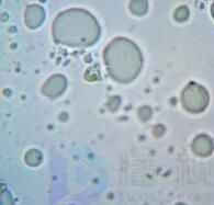 人体缺蛋白质缺会影响气血吗(人体缺蛋白质缺会影响气血吗女性)