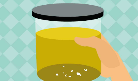 收孕妇尿的赚钱吗