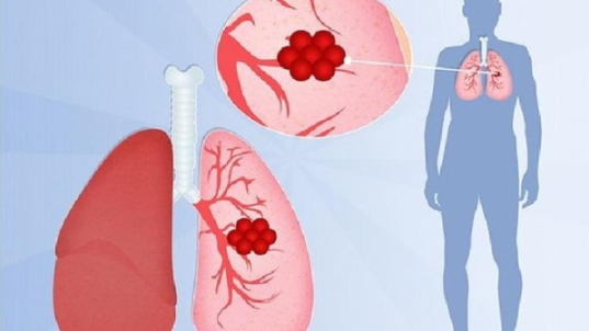 支原体肺炎是新冠吗