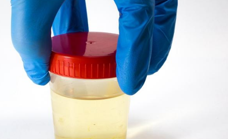 收孕妇尿的赚钱吗