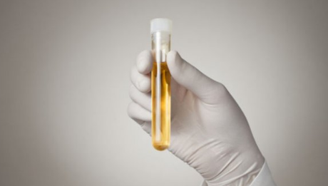 收孕妇尿液违法吗收孕妇尿液是骗局吗(收孕妇尿的赚钱吗)