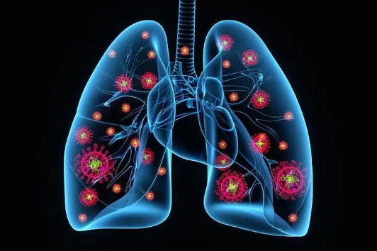 支原体肺炎很容易传染吗