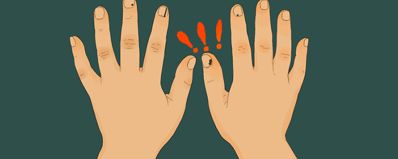 指甲上的月牙代表什么为什么手指没有月牙(手指甲上为什么没有月牙?)