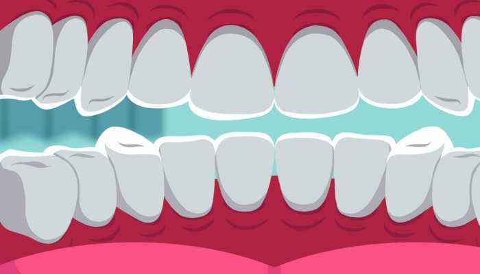 牙缝变大是什么原因导致的