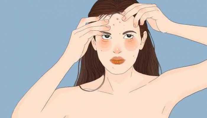 去痘印最有效的小妙招