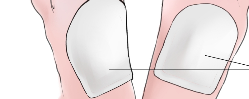 暖宝宝为什么会鼓包为什么暖贴用着会膨胀起来(暖宝宝贴着鼓了是什么情况)