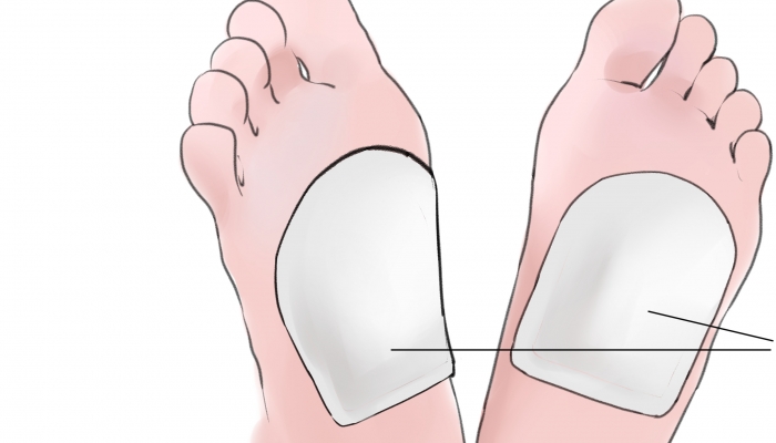 暖宝宝允许带上飞机吗