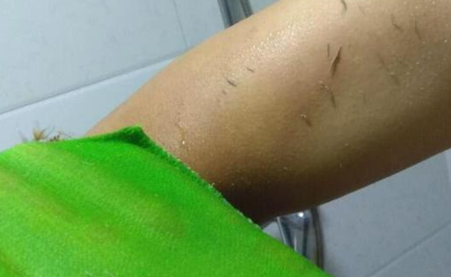 搓澡搓出的泥到底是什么形成的