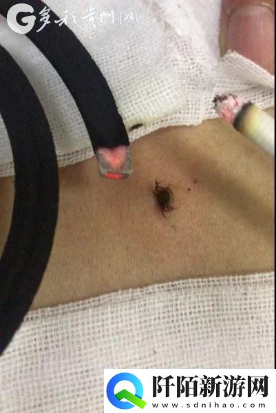 “衣底寄生虫”